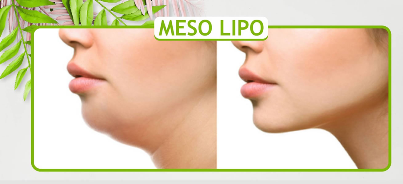 Meso Lipo
